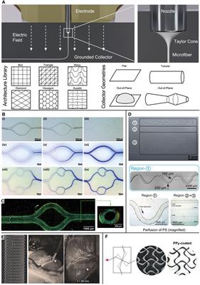 Advances in melt electrowriting for cardiovascular applications